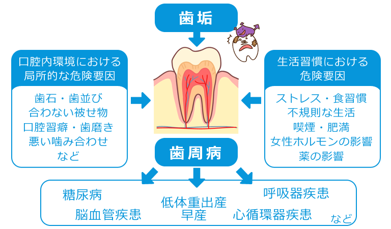 歯周病のリスク
