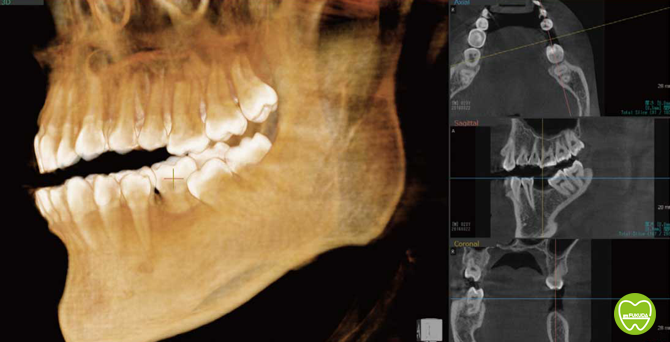歯科用CTレントゲン　邑楽郡　ふくだ歯科医院・小児・矯正歯科