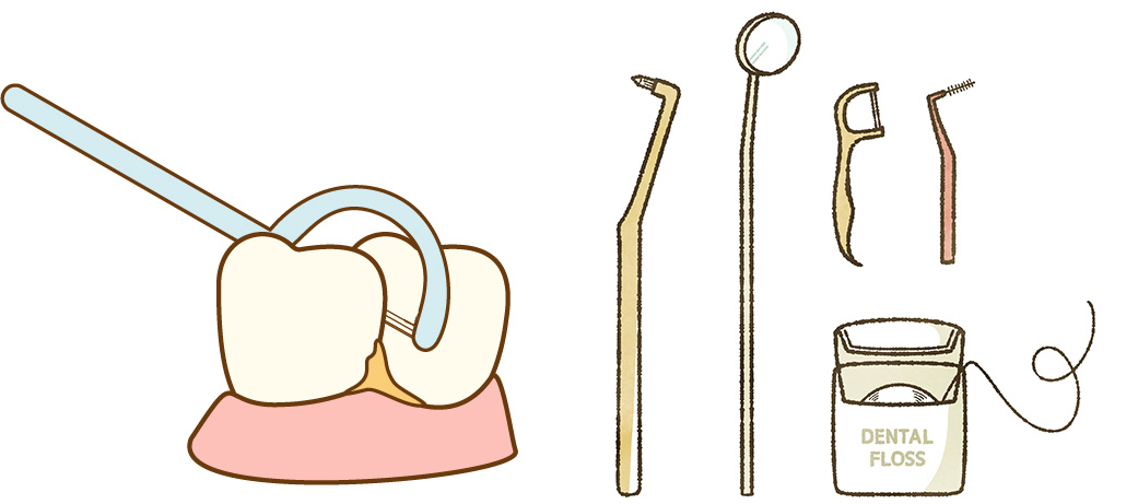 歯と歯の汚れを落とすには｜ふくだ歯科・小児・矯正歯科